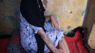 Photo of مفاجأة.. الخبرة الطبية تؤكد أن “فتاة الوشم” لاتزال عذراء!