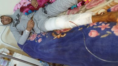 Photo of اعتداء شنيع يتسبب في عاهة مستديمة لشاب ضواحي طنجة والجاني في حالة فرار