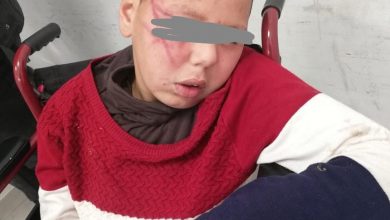 Photo of أمن طنجة يعتقل الشخص الذي “شرمل” وجه طفل