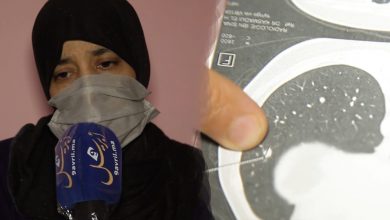 Photo of طنجة: شابة تروي قصة معاناتها مع السرطان خلال الحجر الصحي
