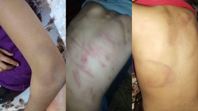 Photo of خطير.. أب يداوم على تعذيب أطفاله وزوجته بطنجة -صور-
