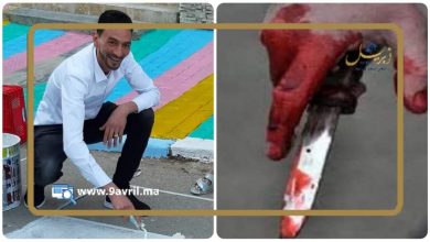 Photo of تلقى 16 طعنة.. عملية جراحية ناجحة لخياط “المرس” المطعون وحالته مستقرة