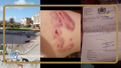 Photo of الناظور.. كلاب ضالة ترسل امرأتين للمستعجلات بجروح خطيرة