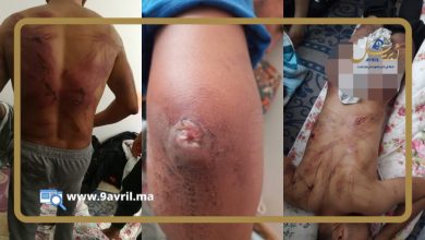Photo of بشع.. جنود يونانيون يعذبون مغربيا ويتسببون في وفاته