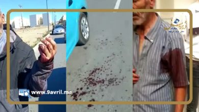 Photo of طنجة..سائق سيارة أجرة يتعرض لاعتداء شنيع بالسلاح الأبيض
