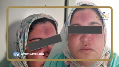 Photo of مكناس.. محام اعتدى على سيدة واستخدم نفوذه مع عناصر أمنية لطمس الملف