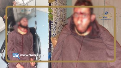 Photo of أصيلة.. اعـ ـ ـتداء شـ ـنيـ ـع على مؤذن مسجد ومواطنون غاضبون من تنامي الإ جـ ـرام بالمدينة