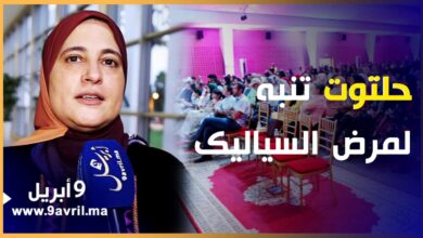 Photo of أقامت سهرة فنية للتحسيس بالمرض .. “حلتوت” تنبه لمرض السياليك وخطورته