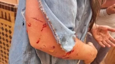 Photo of مرة اخرى.. نجاة سائحة اجنبية من موت محقق بعد هجوم شرس من كلاب ضالة