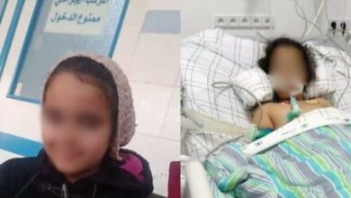 Photo of طفلة تفقد سمعها وبصرها وتصاب بالشلل بعد عملية بسيطة لاستئصال اللوزتين