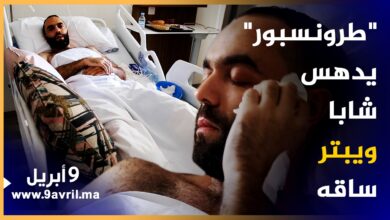 Photo of تسبب في بتر ساقه.. شاب صدمته حافلة للنقل السري يروي تفاصيل مرعبة حول الحادث