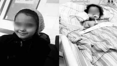 Photo of بعد دخولها في غيبوبة لأكثر من 3 أشهر..  وفاة الطفلة سلمى ضحية عملية اللوزتين