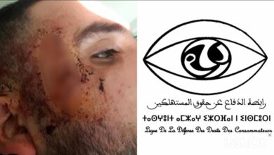 Photo of رابطة الدفاع عن حقوق المستهلكين بطنحة تدين الاعتداء الخطير على نائب رئيس الرابطة