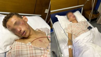 Photo of طنجة.. لصوص يعرضون شابا يتيما لاعتداء خطير (صور+فيديو)