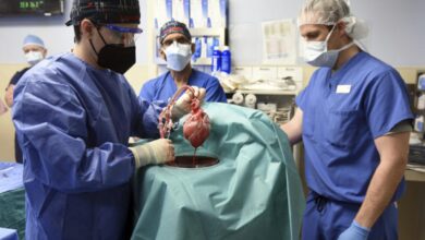Photo of في أقل من عامين.. زرع قلب خنزير في جسم إنسان للمرة الثانية