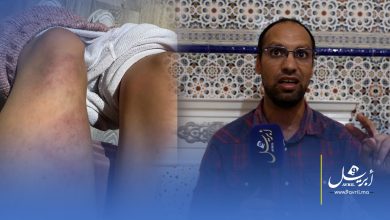 Photo of صادم..طفلة من ذوي الاحتياجات تتعرض للاعتداء داخل مؤسسة خاصة ووالدها يتهم الإدارة بالتستر على الفاعل