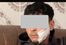 Photo of شرطة طنجة تفك لغز اعتداء مروع خلف عاهة مستديمة لشاب وتوقف ثلاثة أشخاص