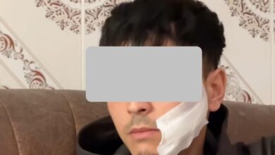 Photo of شرطة طنجة تفك لغز اعتداء مروع خلف عاهة مستديمة لشاب وتوقف ثلاثة أشخاص