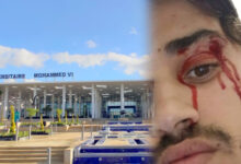 Photo of الاعتداء على رجل أمن داخل “CHU طنجة”ينتهي بالاعتقال والملاحقة القضائية
