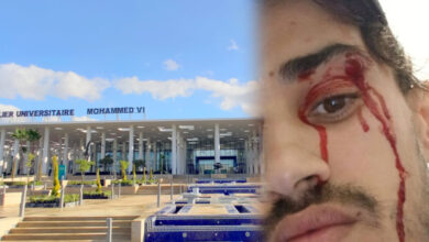 Photo of الاعتداء على رجل أمن داخل “CHU طنجة”ينتهي بالاعتقال والملاحقة القضائية