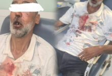 Photo of الجناة في حالة فرار.. عصابة بحي مرشان تعتدي على مسن وترسله في حالة خطيرة  إلى المستشفى الجامعي