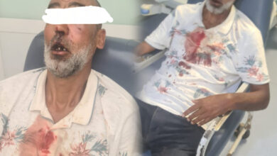 Photo of الجناة في حالة فرار.. عصابة بحي مرشان تعتدي على مسن وترسله في حالة خطيرة  إلى المستشفى الجامعي