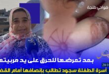 Photo of بعد تعرضها للحرق على يد مربيتها.. أسرة الطفلة سجود تطالب بإنصافها أمام القضاء