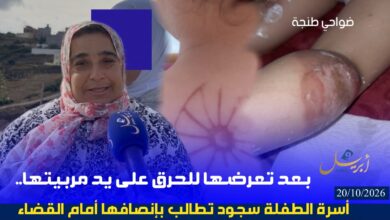 Photo of بعد تعرضها للحرق على يد مربيتها.. أسرة الطفلة سجود تطالب بإنصافها أمام القضاء